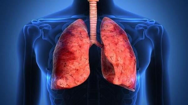 فراوری دارویی که از پیشرفت سرطان ریه جلوگیری می نماید